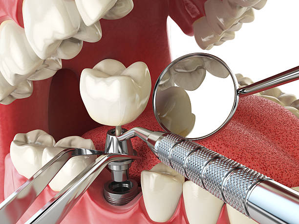 Best Emergency Orthodontic Repairs in Colony Rk, PA